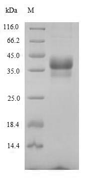 Mouse Antxr1 protein