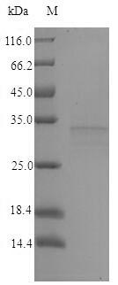 Bacterial vjbR protein
