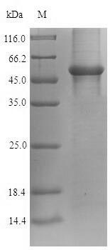 Human GAPDH protein