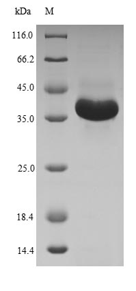 Human MBTPS1 protein
