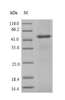 Human NAT2 protein