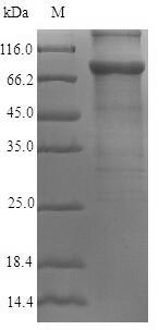 Human AKAP4 protein