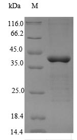 Human PRKAG2 protein