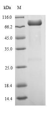 Viral NP protein