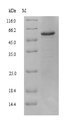 Human ALDH1A2 protein