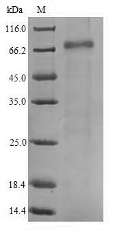Human DCP1B protein