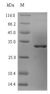 Bacterial omcB protein