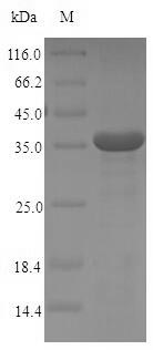 Human FCER1A protein