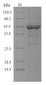 Human FCER1A protein
