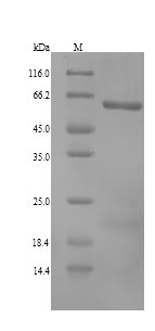 Human ALDH1A3 protein