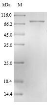 Viral Nucleoprotein protein