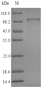 Human ALDH1A3 protein