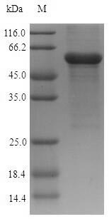 Human ASAH1 protein