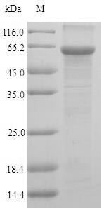Human UAP1 protein
