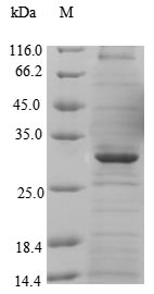 Human MFSD8 protein