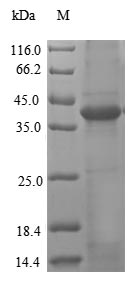 Human LGMN protein