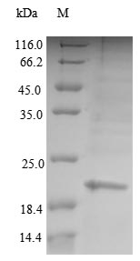 Human PAEP protein
