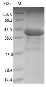 Human PPP1CB protein