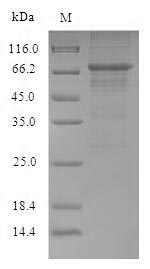 Viral NP protein