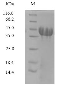 Rat Amigo3 protein