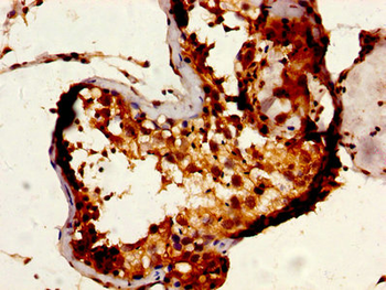 RUVBL1 Antibody