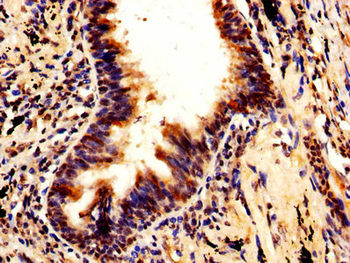 RUVBL1 Antibody