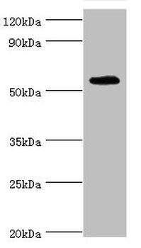 TSEN2 Antibody