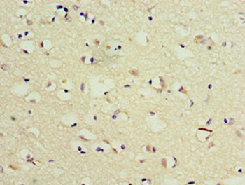 TSEN2 Antibody