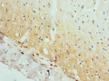 AP2A2 Antibody