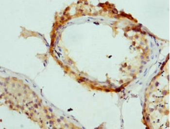 AP2A2 Antibody