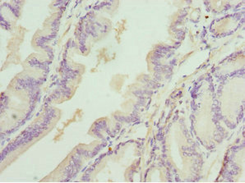 DEDD Antibody
