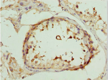 DEDD Antibody