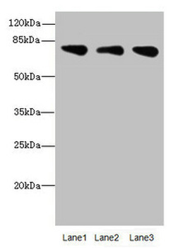 ACSS2 Antibody