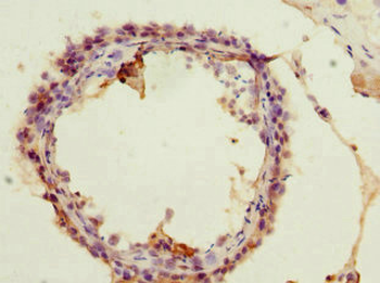 ACSS2 Antibody