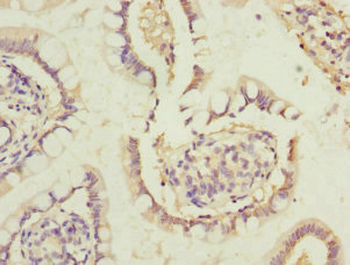 DHDH Antibody