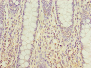 DHDH Antibody