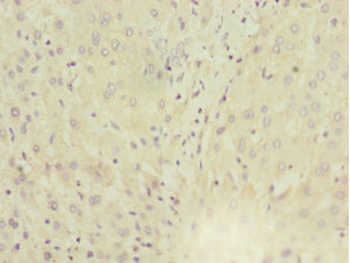 MGAT1 Antibody