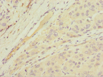 MGAT1 Antibody