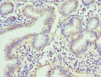 RBP2 Antibody