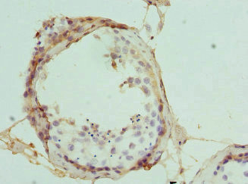 INTS11 Antibody