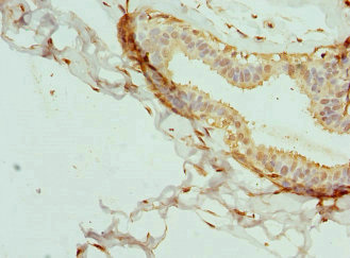 INTS11 Antibody