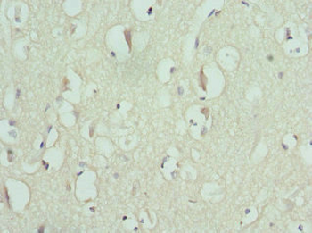 ENTPD2 Antibody