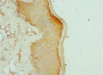 KIF2B Antibody