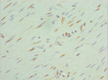 SEPHS1 Antibody