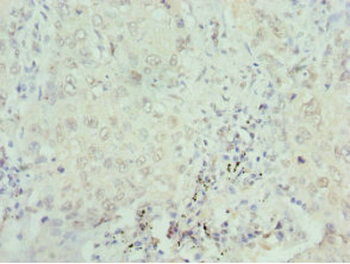 SEPHS1 Antibody