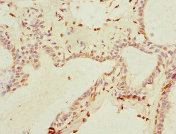 THRSP Antibody