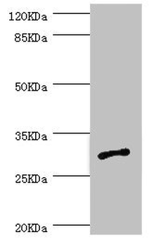 AGPAT2 Antibody