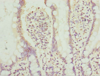 AGPAT2 Antibody