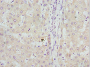 GBE1 Antibody