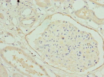 HGD Antibody